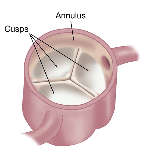A medical illustration of the aortic valve showing the cusps and annulus
